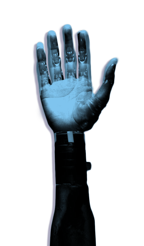 protesis de mano robotizada